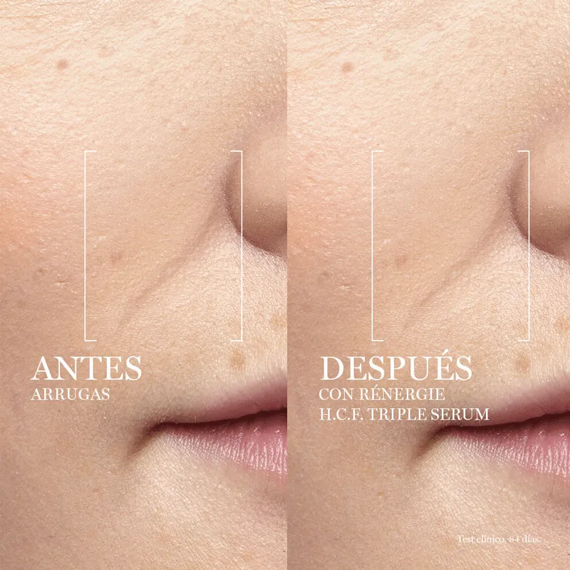 RENERGIE H.C.F. TRIPLE SERUM - LANCOME | ESENNIA